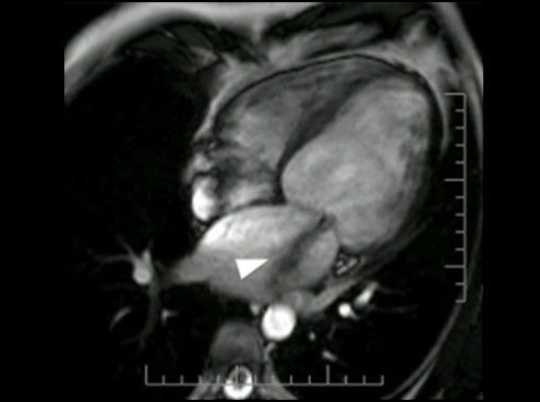 Kardio-MRT - Kardiale Magnetresonanz Tomografie im CardioCentrum Düsseldorf