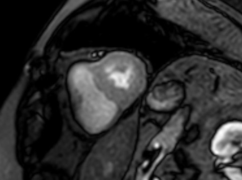 Stress Kardio-MRT im CardioCentrum Düsseldorf