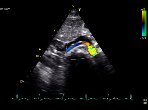 Diagnostik arterieller Verschlusskrankheit im CardioCentrum Düsseldorf