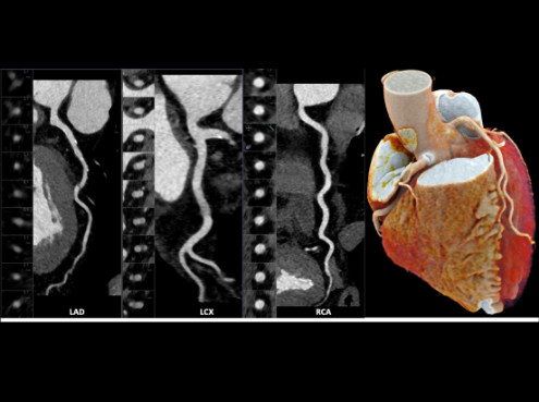 Kardio-CT im CardioCentrum Düsseldorf