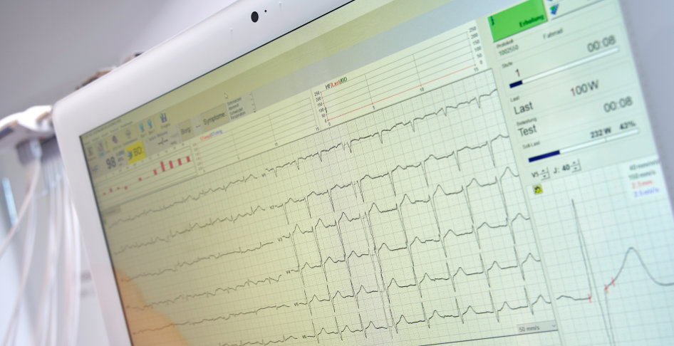 Leistungen der Kardiologie im CardioCentrum Düsseldorf