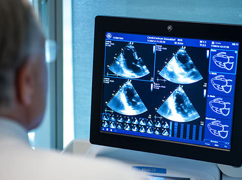 Echokardiographie im CardioCentrum Düsseldorf