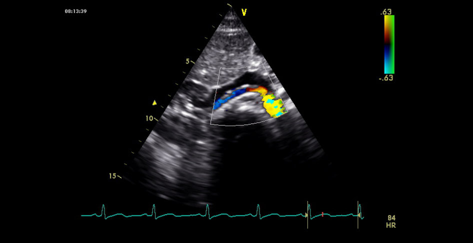 Nicht-invasive Angiologie im CardioCentrum Düsseldorf